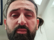 Gözüne yakıcı madde sıktı telefonu alıp kaçtı