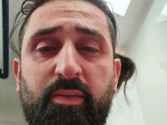 Gözüne yakıcı madde sıktı telefonu alıp kaçtı